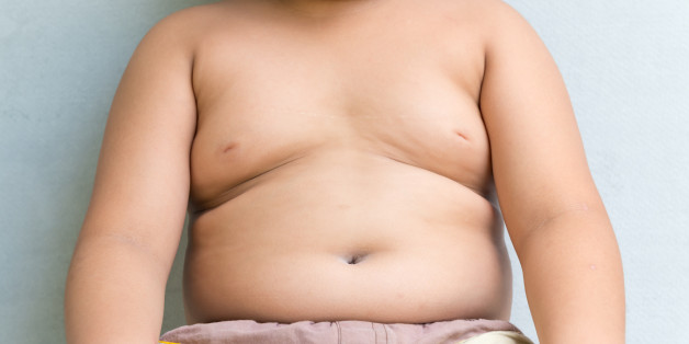 The size of stomach of children with overweight.