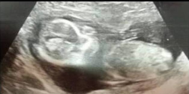 Megan ist ein Wunschkind und ein Wunderbaby