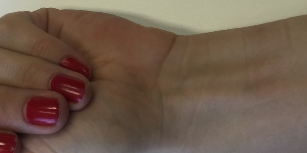 Das bedeuten die Linien an deinem Handgelenk. Und sie sagen viel über deine Gesundheit aus
