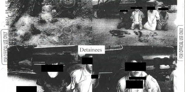 This image provided by the Department of Defense shows one of the 198 photos of detainees in Iraq and Afghanistan, involving 56 cases of alleged abuse by U.S. forces, that were released Friday, Feb. 5, 2016, in response to a Freedom of Information request from the American Civil Liberties Union. The often dark, blurry and grainy pictures are mainly of detainees' arms and legs, with faces redacted by the military, revealing bruises and cuts, and they appear far less dramatic than those released more than a decade ago during allegations of torture at Iraq's Abu Ghraib prison. (Department of Defense via AP)