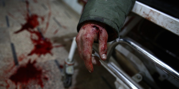EDITORS NOTE: Graphic content / The body of a Syrian man lies on a stretcher at a make-shift hospital following airstrikes on the rebel-held town of Douma, on the eastern edges of the Syrian capital Damascus on January 16, 2016.
/ AFP / Abd Doumany (Photo credit should read ABD DOUMANY/AFP/Getty Images)