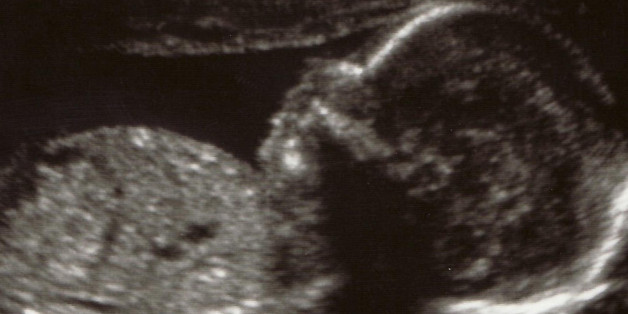 Schon im Uterus macht dieses Baby seinen Eltern Hoffnung