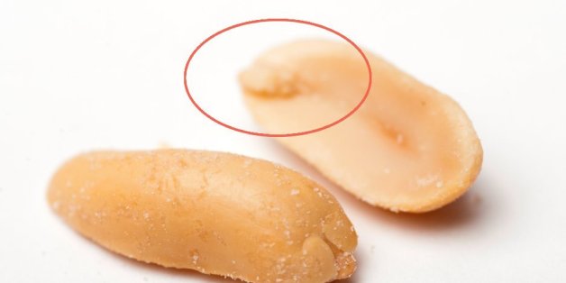 Das steckt hinter dem kleinen Stückchen in jeder Erdnuss