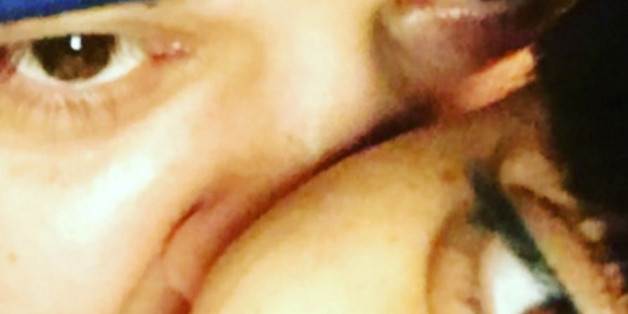 Rob Kardashian