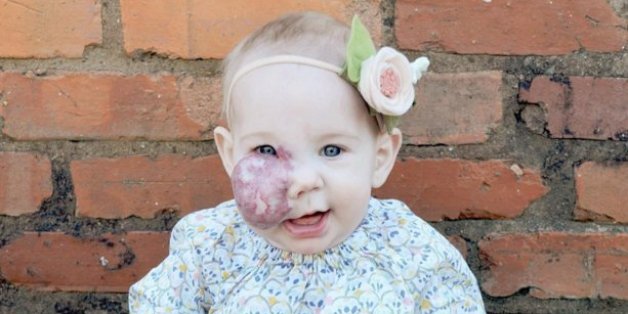 Elle prend des photos magnifiques pour briser les tabous autour de la tâche de naissance de sa fille