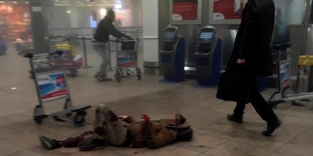 Ein Verletzter nach den Anschlägen am Brüsseler Flughafen
