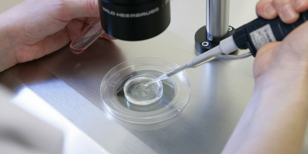In vitro fertilization, Reproductive biology laboratory University hospital of Rouen, France. (Photo by: Media for Medical/UIG via Getty Images)