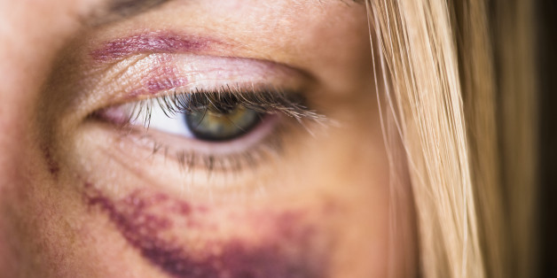 Ein 14-jähriges Mädchen in Geldern wurde Opfer eines brutalen Überfalls