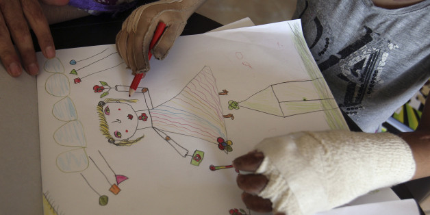 Kamar, a Syrian refugee girl who was injured during the violence in her country, draws during a psychological therapy session in Amman October 11, 2012. Kamar has undergone multiple reconstructive surgeries and is one of dozens of refugees that attend the daily therapy sessions run by French aid organization Medicins Sans Frontieres (Doctors Without Borders). REUTERS/Ali Jarekji (JORDAN - Tags: POLITICS CIVIL UNREST CONFLICT HEALTH)
