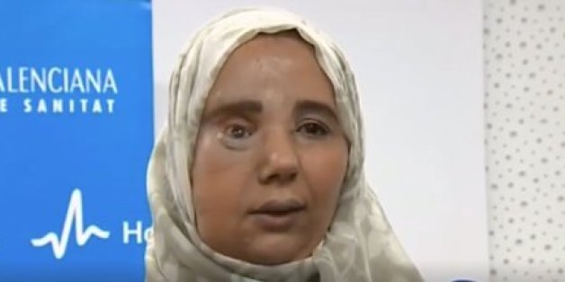 La nouvelle vie de Samira Benhar, la Marocaine sauvée par un chirurgien espagnol