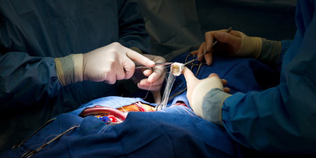 Un staff médical réalise une chirurgie cardiaque minutieuse, la première du genre dans l'Oriental