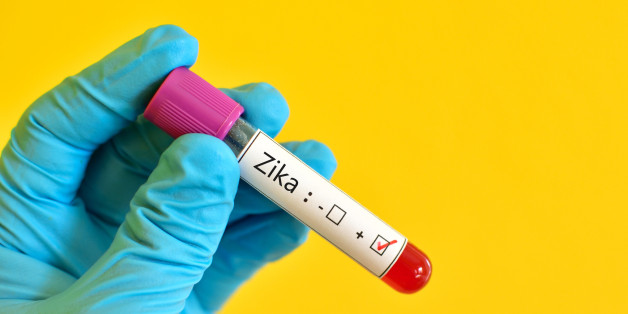 Blood sample positive with Zika virus