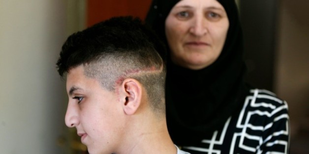 Le jeune Palestinien Ahmed Abu al-Homs montre ses cicatrices, à côté de sa mère, à Jérusalem le 7 avril 2016