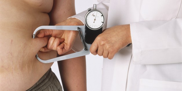 Doctor using calipers to give overweight boy a skin-fold test, torso front view.