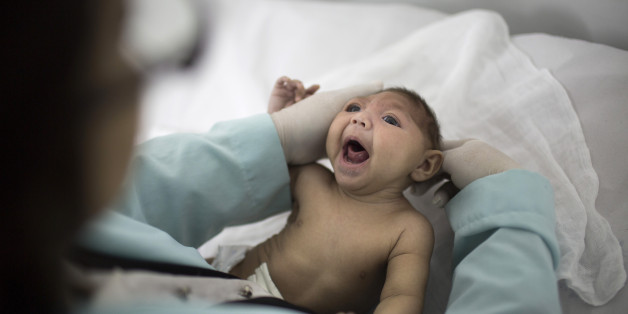 In this Feb. 12, 2016 photo, Lara, who is just under 3- months-old and was born with microcephaly, is examined by a neurologist at the Pedro I hospital in Campina Grande in Paraiba state, Brazil. Paraiba and Pernambuco in BrazilÃs impoverished northeast are ground zero for the Zika epidemic. Since Zika was first detected in Brazil, the two states have accounted for almost half of the 6,158 reported cases of babies born with shrunken heads, a rare condition known as microcephaly. (AP Photo/Fel