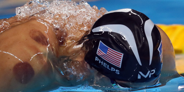 Ces taches rouges sur le corps de Michael Phelps sont les traces du "cupping"