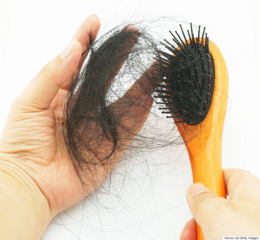 Hair Loss And Hair Thinning
