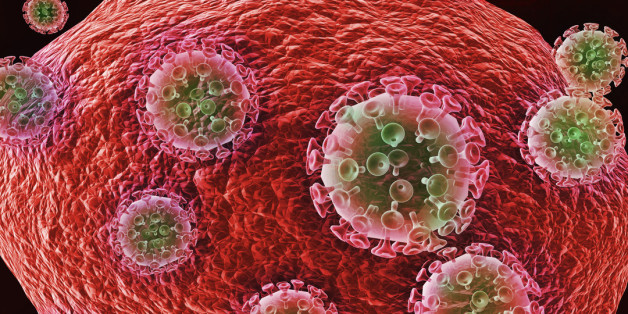 An illustration of the deadly Human Immunodeficiency Virus (HIV/AIDS) viruses surrounding and attacking a host cell.