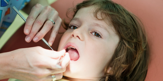 Auswertung zeigt: Nur ein Drittel der Kinder geht überhaupt zum Zahnarzt