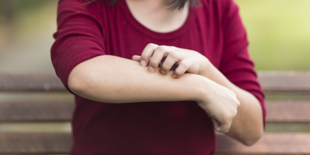 Woman Scratching Her Arm Sitting on Bench at Park