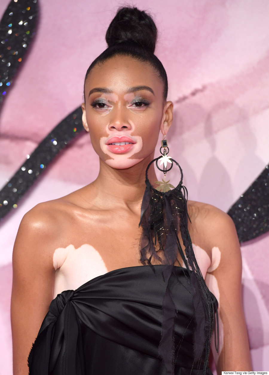 Winnie Harlow Stuns In Baja East Slit Gown At The 2016 British Fashion
