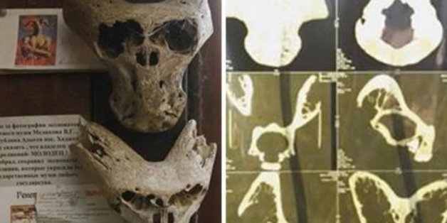 Russen finden mysteriöse Knochen in Nazi-Koffer – Forscher haben einen Verdacht, wem sie gehören