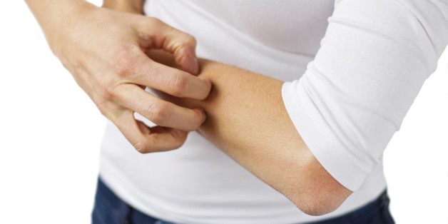 Woman suffering with dry and itchy skin, scratching her arm.