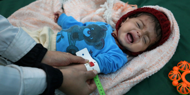 A malnourished Yemeni boy is attended to at a therapeutic feeding centre in the country's third-largest city of Taez, on December 17, 2016.The UN children's agency UNICEF says nearly three million people in Yemen need immediate food supplies, while 1.5 million children are suffering from malnutrition, including 370,000 with severe malnutrition that weakens their immune system. / AFP / Ahmad AL-BASHA (Photo credit should read AHMAD AL-BASHA/AFP/Getty Images)