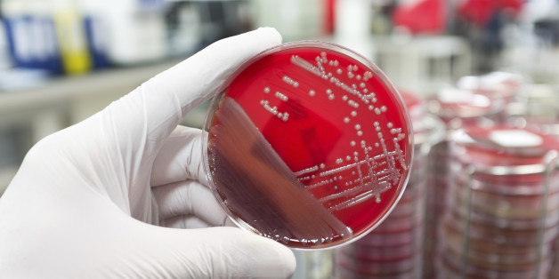 A hand with a medical glove is holding a agar plate with a culture of a pathogenic bacteria.