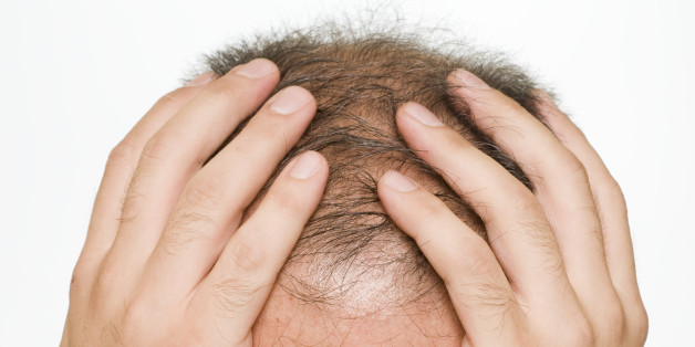 Balding, to become bald