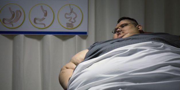 Mexican 32-year-old Juan Pedro Franco, who weighs almost 500 kilograms (1100 pounds) answers questions during a press conference at the hospital in Guadalajara, Mexico on December 21, 2016.
Franco, who suffers from extreme obesity and has remained six years confined to bed, unable to walk, is being assessed by doctors and will begin a special diet and exercise routine with the aim to lose 59 kilograms before undergoing a by-pass biliopancreatic diversion in two times in June 2017. / AFP / Héctor Guerrero (Photo credit should read HECTOR GUERRERO/AFP/Getty Images)