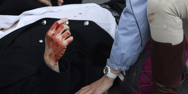 An injured man is assisted after an attack on Westminster Bridge in London, Britain March 22, 2017. REUTERS/Toby Melville