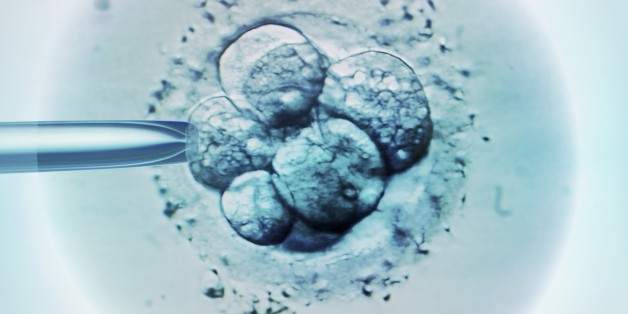 Embryo selection for IVF, light micrograph.