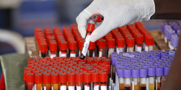 A volunteer collects samples of blood donated to help the survivors of Thursday's attack by gunmen at Garissa University in Kenya's capital Nairobi April 6, 2015. The Kenyan air force has destroyed two al Shabaab camps in Somalia, it said on Monday, in the first major military response since the Islamist group massacred students at a Kenyan university last week. REUTERS/Thomas Mukoya