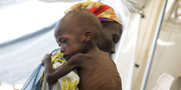 WAU SHILUK, SOUTH SUDAN - MAY 10: Doctors Without Borders screens and treats malnourished children living in and around Wau Shiluk, who were internally displaced from Malakal, during a mobile clinic for malnourished children in the Upper Nile region, South Sudan, May 10, 2014. Roughly one million Southern Sudanese have been displaced from their homes in the last five months as the civil war rages in the country, pitting ethnic Nu'er against Dinka. Most civilians have not been able to plant their crops because of the fighting, and if the civil war continues, South Sudan will face one of the biggest famines in the region in decades. (Photo by Lynsey Addario/Getty Images Reportage)