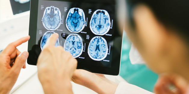 Wissenschaftler haben den "sechsten Sinn" im menschlichen Gehirn entdeckt