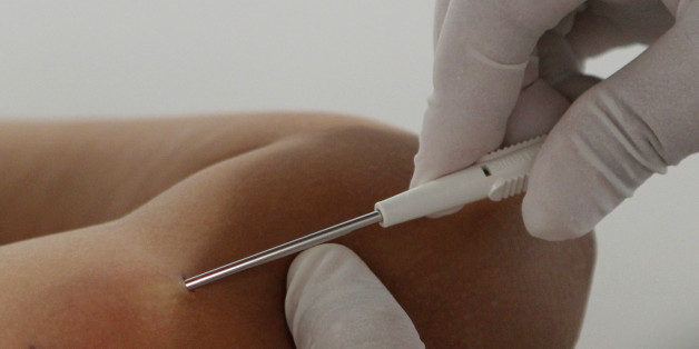Un projet pilote sur l'implant contraceptif a été mené à Fès et à Casablanca