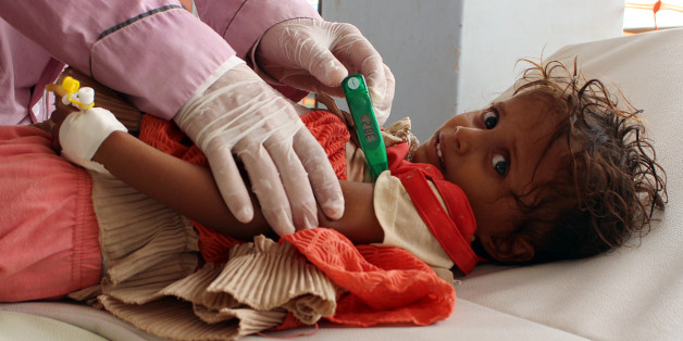 TOPSHOT - A Yemeni child suspected of being infected with cholera is checked by a doctor at a makeshift hospital operated by Doctors Without Borders (MSF) in the northern district of Abs in Yemen's Hajjah province , on July 16, 2017.
The country has also been hit by a cholera outbreak that has killed more than 1,600 people and left some 270,000 infected. / AFP PHOTO / STRINGER (Photo credit should read STRINGER/AFP/Getty Images)