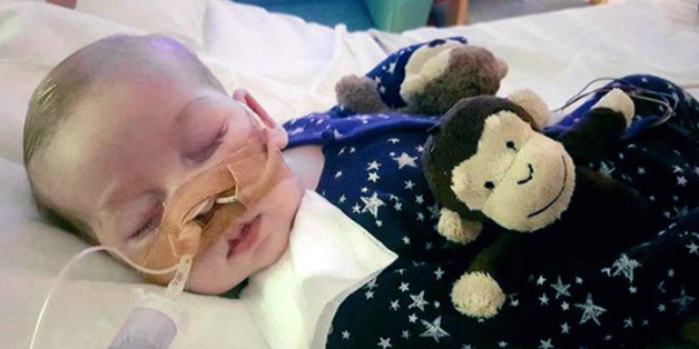 Seit elf Monaten kämpft Baby Charlie ums Überleben