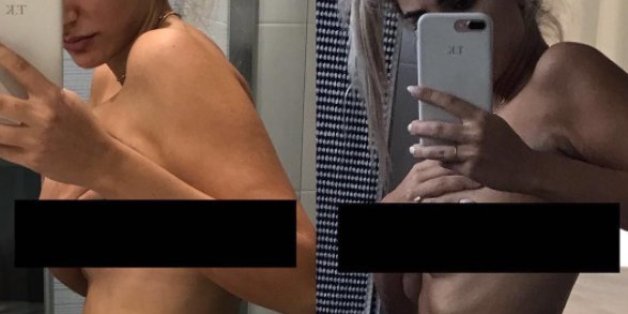 Mit diesem Bild zeigt eine Frau die schrecklichen Folgen von Endometriose
