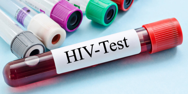 Sample blood collection tube with HIV test label in laboratory.