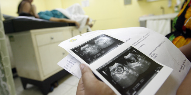 Ultrasound scans are pictured near a woman during a pre-natal check at the government run Dr. Jose Fabella Memorial Hospital in Manila June 6, 2011. The maternity ward, the busiest in the country, sees an average of 60 births a day. The Philippines' population growth rate of around 2.0 percent is above Southeast Asia's average of around 1.7 percent, with an estimated 200 babies born every hour. Lack of a national policy on birth control and access to modern family planning methods -- frowned upon by the powerful Catholic church -- are some of the factors that have led to the country's population ballooning to nearly 100 million, according to various government and private sector estimates, with the Philippines the second most populous nation in the region after Indonesia. REUTERS/Cheryl Ravelo (PHILIPPINES - Tags: SOCIETY HEALTH)