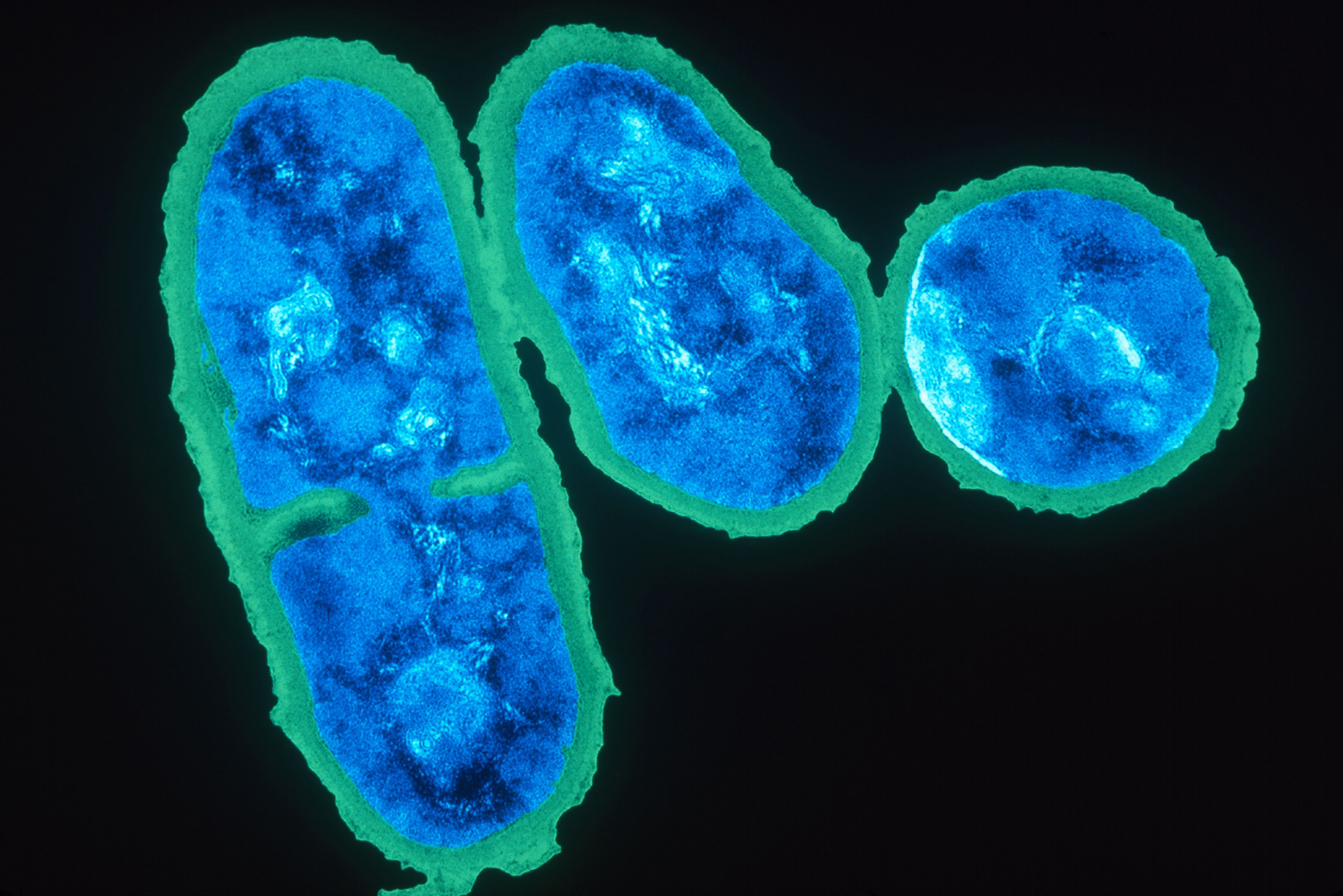 propionibacterium