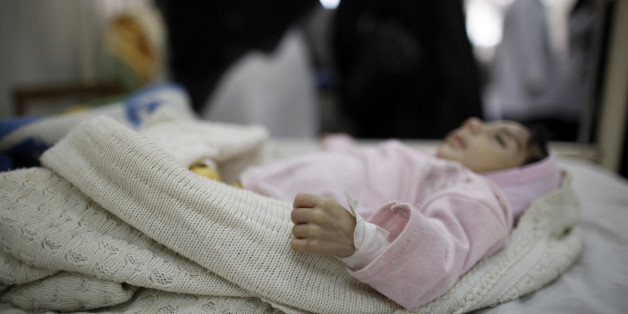A malnourished child sleeps inside a ward at Assabiyn hospital in Sanaa February 11, 2012. Political turmoil has pushed Yemen, already one of the poorest countries in the Arab world, to the brink of a humanitarian crisis to rival the one that ravaged the Horn of Africa last year.The United Nations Children's Fund, UNICEF, says 57 percent of Yemen's 12 million children are chronically malnourished -- the highest level of chronic malnutrition in the world after Afghanistan. Picture taken February 11, 2012. To match Feature YEMEN-CHILDREN/ REUTERS/Khaled Abdullah (YEMEN - Tags: SOCIETY POVERTY HEALTH)