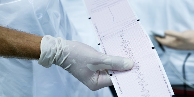Berlin, Germany - August 12: A doctor holds an electrocardiogram in the emergency room of a hospital on August 12, 2015 in Berlin, Germany. (Photo by Michael Gottschalk/Photothek via Getty Images)