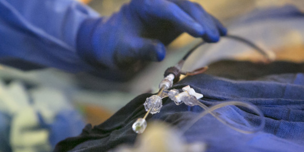 PORTLAND, ME - SEPTEMBER 21: The deployment and placement of the Watchman device is controlled by a small knob at the end of a catheter, seen here during a procedure on patient Paul Rice in an operating room at Maine Medical Center on Thursday, September 21, 2017. The catheter is run up the femoral artery in to Rice's heart where the device is set. Rice has atrial fibriliation, which causes clots to form in an area of the heart, which puts him at a greatly increased risk of a stroke. Rice has be
