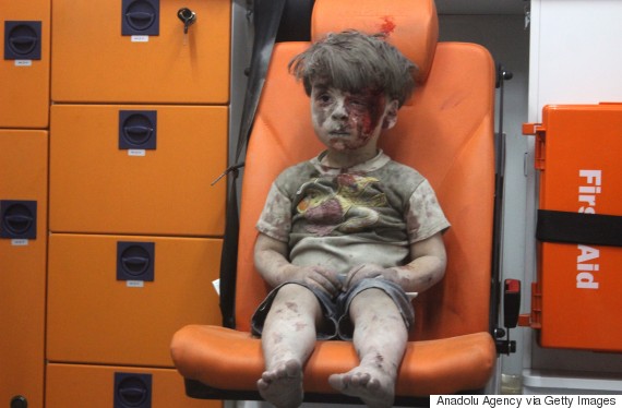 omran daqneesh