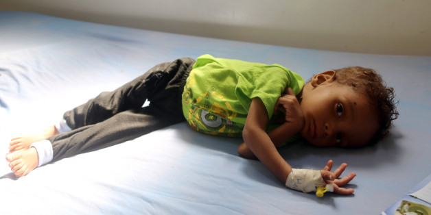 A malnourished Yemeni child receives treatment at a hospital in the Yemeni port city of Hodeidah, on November 21, 2017. The United Nations has warned that war-wracked Yemen faces a mass famine unless aid deliveries are allowed to enter the impoverished country. Some 17 million Yemenis are in desperate need of food, seven million of whom are at risk of famine, according to UN figures. The UN said in August that more than 20 million people are at risk from famine in Yemen, Somalia, South Sudan and