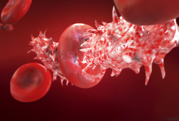 virus