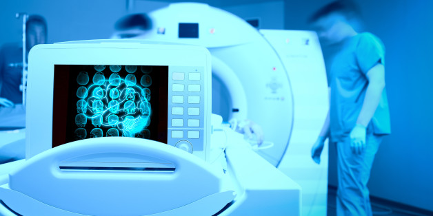 MRI scan on the monitor of patient`s head